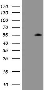 ZIC3 Antibody in Western Blot (WB)