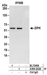 ZIPK Antibody in Immunoprecipitation (IP)