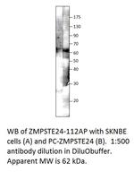 ZMPSTE24 Antibody in Western Blot (WB)