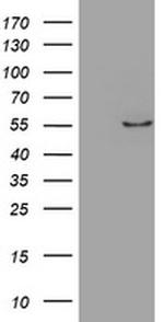 ZNF165 Antibody in Western Blot (WB)