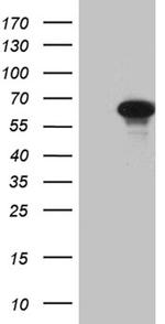 ZNF181 Antibody in Western Blot (WB)