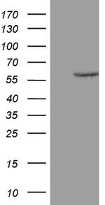 ZNF213 Antibody in Western Blot (WB)