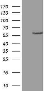 ZNF213 Antibody in Western Blot (WB)