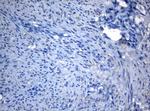 ZNF217 Antibody in Immunohistochemistry (Paraffin) (IHC (P))