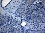 ZNF217 Antibody in Immunohistochemistry (Paraffin) (IHC (P))