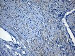 ZNF217 Antibody in Immunohistochemistry (Paraffin) (IHC (P))