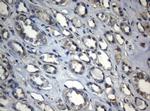 ZNF217 Antibody in Immunohistochemistry (Paraffin) (IHC (P))