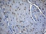 ZNF217 Antibody in Immunohistochemistry (Paraffin) (IHC (P))