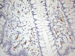 ZNF217 Antibody in Immunohistochemistry (Paraffin) (IHC (P))