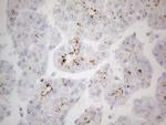 ZNF217 Antibody in Immunohistochemistry (Paraffin) (IHC (P))