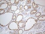 ZNF217 Antibody in Immunohistochemistry (Paraffin) (IHC (P))