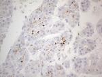 ZNF217 Antibody in Immunohistochemistry (Paraffin) (IHC (P))