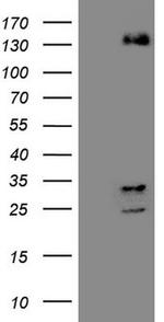 ZNF217 Antibody in Western Blot (WB)