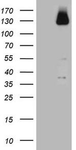 ZNF217 Antibody in Western Blot (WB)