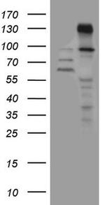 ZNF217 Antibody in Western Blot (WB)