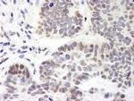 ZNF261 Antibody in Immunohistochemistry (IHC)