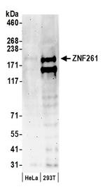 ZNF261 Antibody in Western Blot (WB)