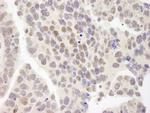 ZNF261 Antibody in Immunohistochemistry (IHC)