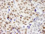 ZNF261 Antibody in Immunohistochemistry (IHC)