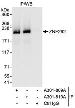 ZNF262 Antibody in Immunoprecipitation (IP)