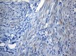 ZNF394 Antibody in Immunohistochemistry (Paraffin) (IHC (P))