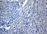 ZNF394 Antibody in Immunohistochemistry (Paraffin) (IHC (P))