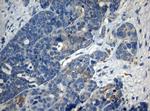 ZNF394 Antibody in Immunohistochemistry (Paraffin) (IHC (P))