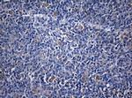 ZNF394 Antibody in Immunohistochemistry (Paraffin) (IHC (P))