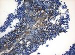 ZNF394 Antibody in Immunohistochemistry (Paraffin) (IHC (P))