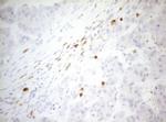 ZNF394 Antibody in Immunohistochemistry (Paraffin) (IHC (P))