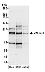 ZNF598 Antibody in Western Blot (WB)