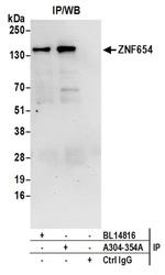 ZNF654 Antibody in Western Blot (WB)