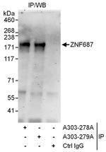 ZNF687 Antibody in Immunoprecipitation (IP)