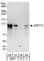 ZNF711 Antibody in Western Blot (WB)