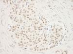 ZNF768 Antibody in Immunohistochemistry (IHC)