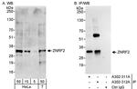 ZNRF2 Antibody in Western Blot (WB)