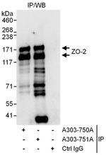 ZO-2 Antibody in Immunoprecipitation (IP)