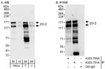 ZO-2 Antibody in Western Blot (WB)