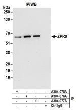 ZPR9 Antibody in Western Blot (WB)