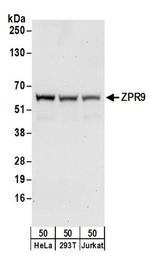ZPR9 Antibody in Western Blot (WB)