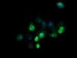 ZSCAN21 Antibody in Immunocytochemistry (ICC/IF)