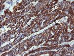 ZSCAN21 Antibody in Immunohistochemistry (Paraffin) (IHC (P))