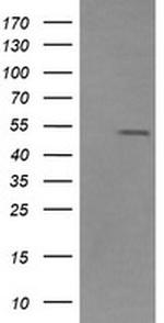 ZSCAN21 Antibody in Western Blot (WB)