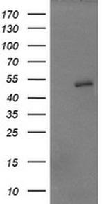 ZSCAN21 Antibody in Western Blot (WB)