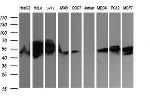 ZSCAN21 Antibody in Western Blot (WB)