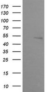 ZSCAN21 Antibody in Western Blot (WB)