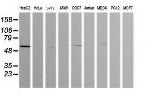 ZSCAN21 Antibody in Western Blot (WB)