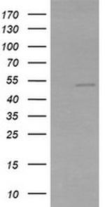 ZSCAN21 Antibody in Western Blot (WB)