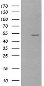 ZSCAN21 Antibody in Western Blot (WB)