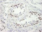 ZWINT-1 Antibody in Immunohistochemistry (IHC)